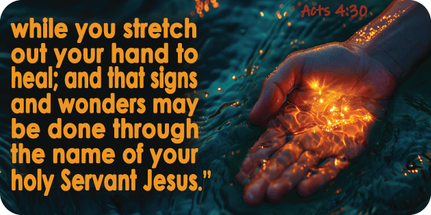 Acts 4 30
