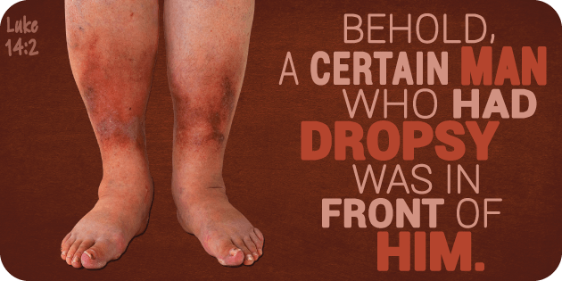 Luke 14 2